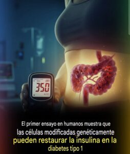 “Primer Trasplante de Células Genéticamente Editadas que Elimina la Insulina en Diabetes Tipo 1”