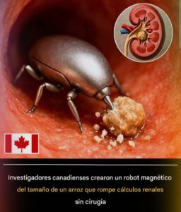 Un Robot del Tamaño de un Grano de Arroz Podría Eliminar las Piedras Renales Sin Cirugía: Un Avance Revolucionario en Medicina Mínimamente Invasiva