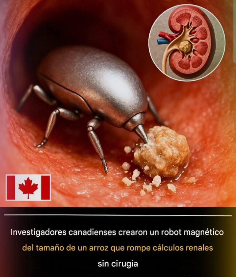 Un Robot del Tamaño de un Grano de Arroz Podría Eliminar las Piedras Renales Sin Cirugía: Un Avance Revolucionario en Medicina Mínimamente Invasiva