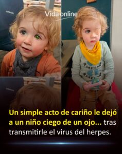 Un beso inocente, una tragedia irreversible: el virus silencioso que le arrebató la vista a un niño de 2 años