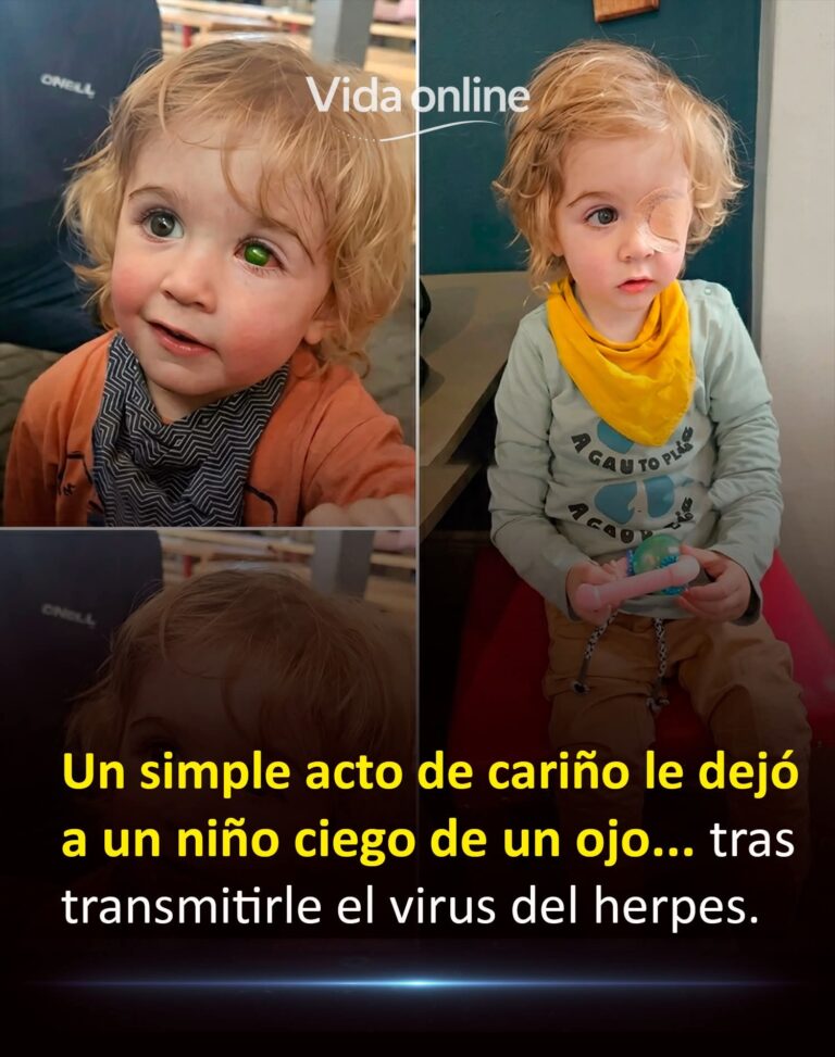 Un beso inocente, una tragedia irreversible: el virus silencioso que le arrebató la vista a un niño de 2 años