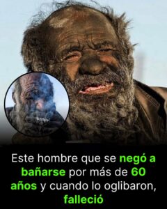 EL PARADÓJICO CASO DE AMOU HAJI: EL HOMBRE QUE PASÓ 60 AÑOS SIN BAÑARSE Y DESAFIÓ TODAS LAS REGLAS DE LA SALUD