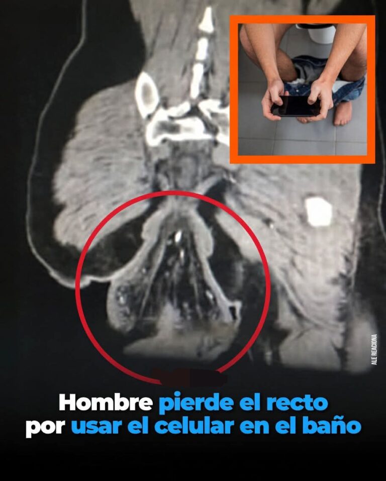 EL PELIGRO SILENCIOSO DE QUEDARTE DEMASIADO TIEMPO EN EL BAÑO CON EL CELULAR