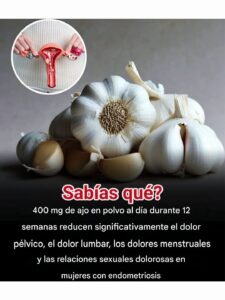 AJO Y ENDOMETRIOSIS: LO QUE DICE LA CIENCIA SOBRE UN POSIBLE ALIVIO NATURAL DEL DOLOR