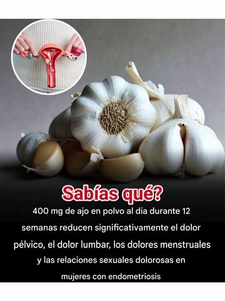 AJO Y ENDOMETRIOSIS: LO QUE DICE LA CIENCIA SOBRE UN POSIBLE ALIVIO NATURAL DEL DOLOR